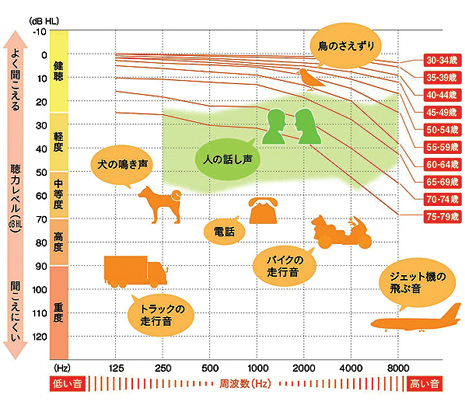 聴力レベル